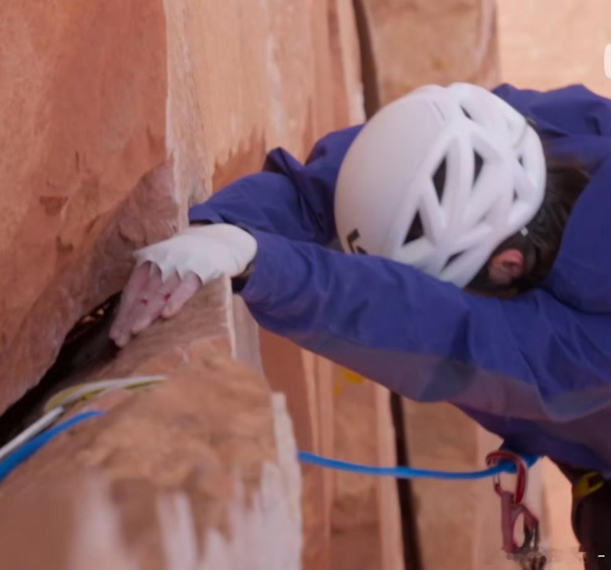 卧槽啊啊啊 才发现王一博又又又又受伤了 我真是没招了王一博粉丝保密协议到期了吗王