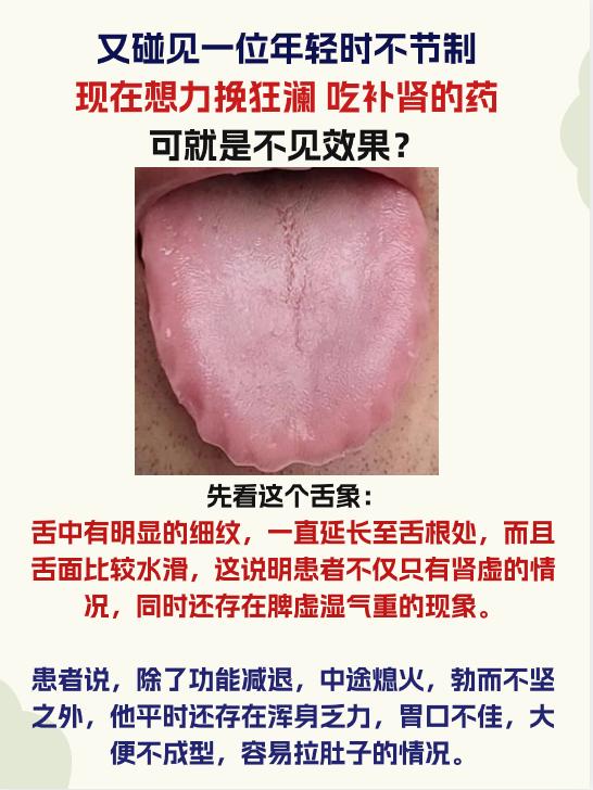 年轻时不节制，现在想力挽狂澜，补肾药吃了一大堆，但是没有什么效果