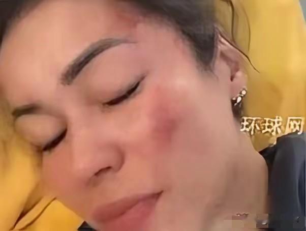 一对西班牙夫妻在印度被7人轮流侵害长达3个小时！2024年3月1日，两人抵达印度