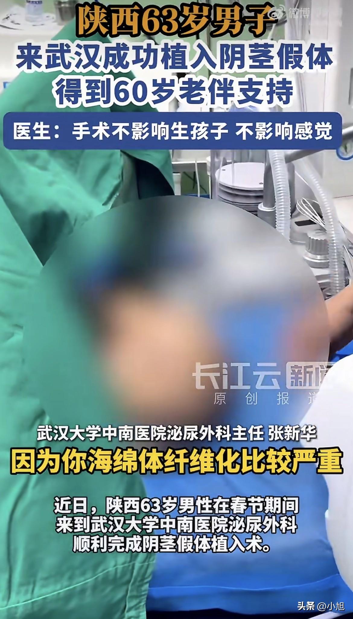 真的没想到，陕西一位63岁的大爷，春节期间跑到武汉做了个手术。
把阴茎假体植进去