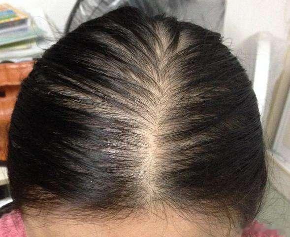 一刷牙就恶心，痰湿一吃补药就上火，痰湿一吃油腻就拉肚子，痰湿一到中年就有肚子，痰