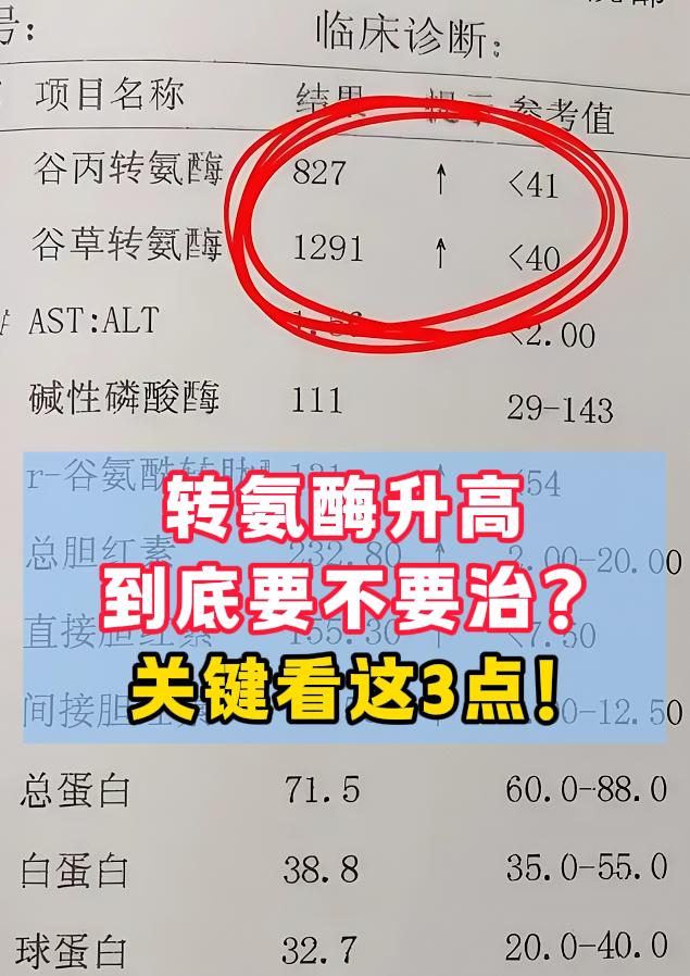 转氨酶升高到底要不要治？关键看这3点！    肝功能检查是肝脏检查时最...