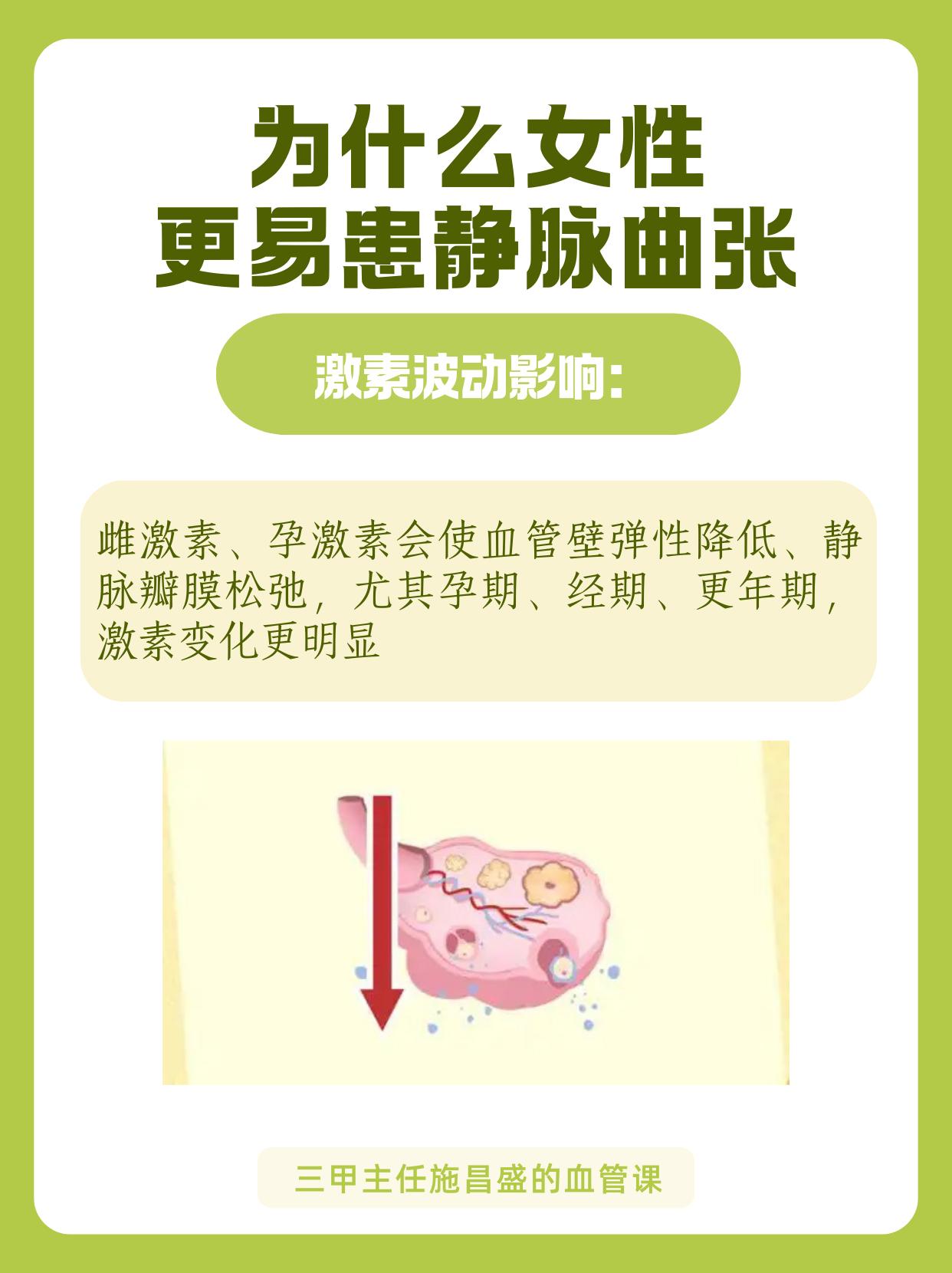 为什么女性更易患静脉曲张。女性静脉曲张发病率是男性的 2-3 倍，关键...