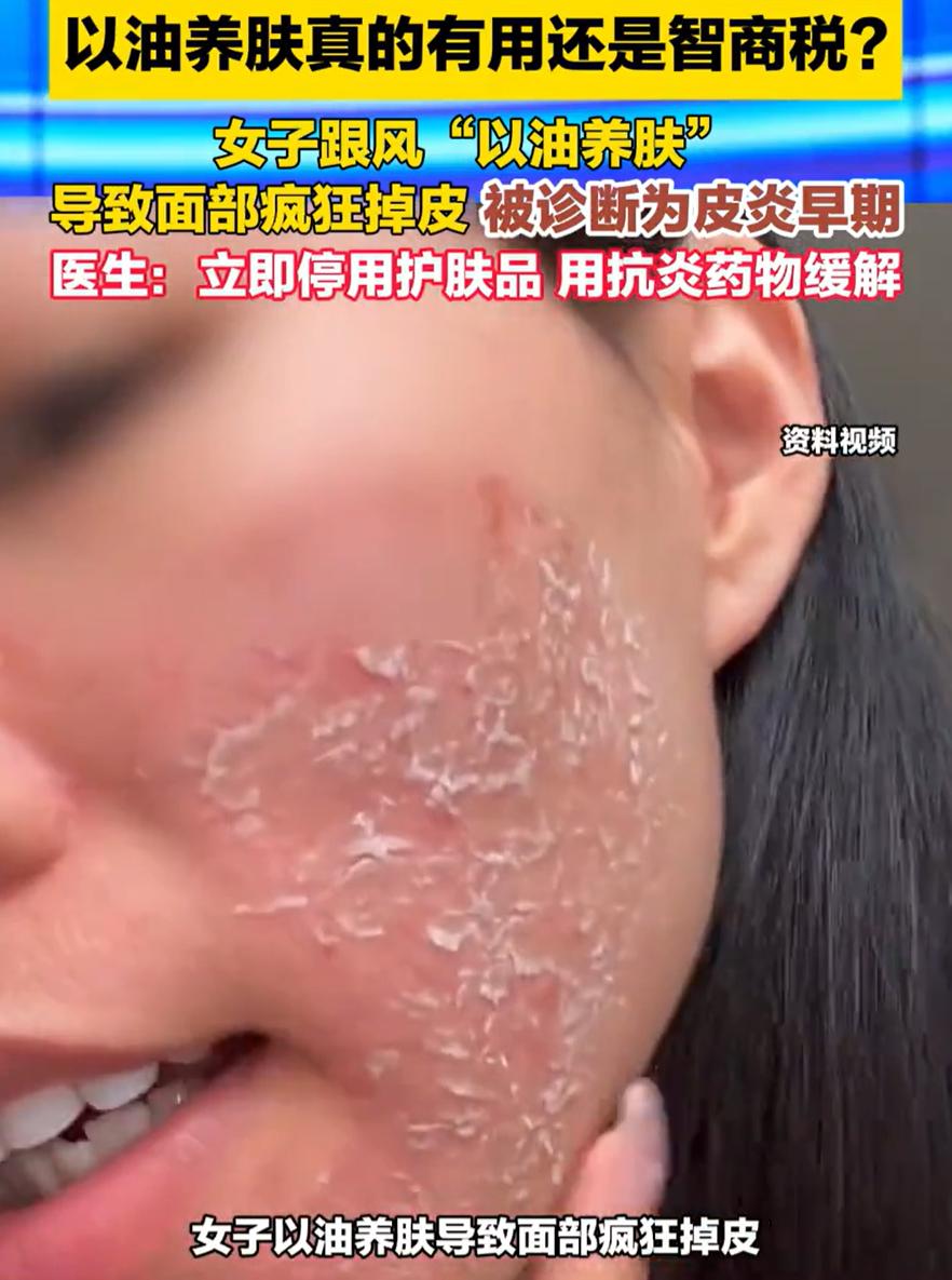 “这到底是啥原因？”福建福州，一女子皮肤干燥，之前听网上说可以“以油养肤”，就跟