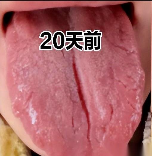 吃了半个月归脾丸，他把空药盒往桌上“啪”一拍，对着我吼：“为什么！为什么舌头上的