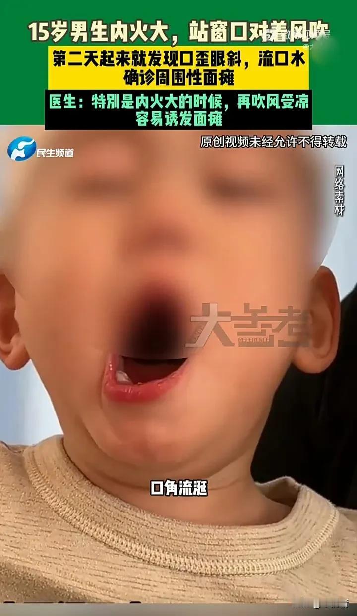 太悲哀了！近日，河南郑州一名15岁男孩站在窗口吹了一会风，结果第二天起来却出现口