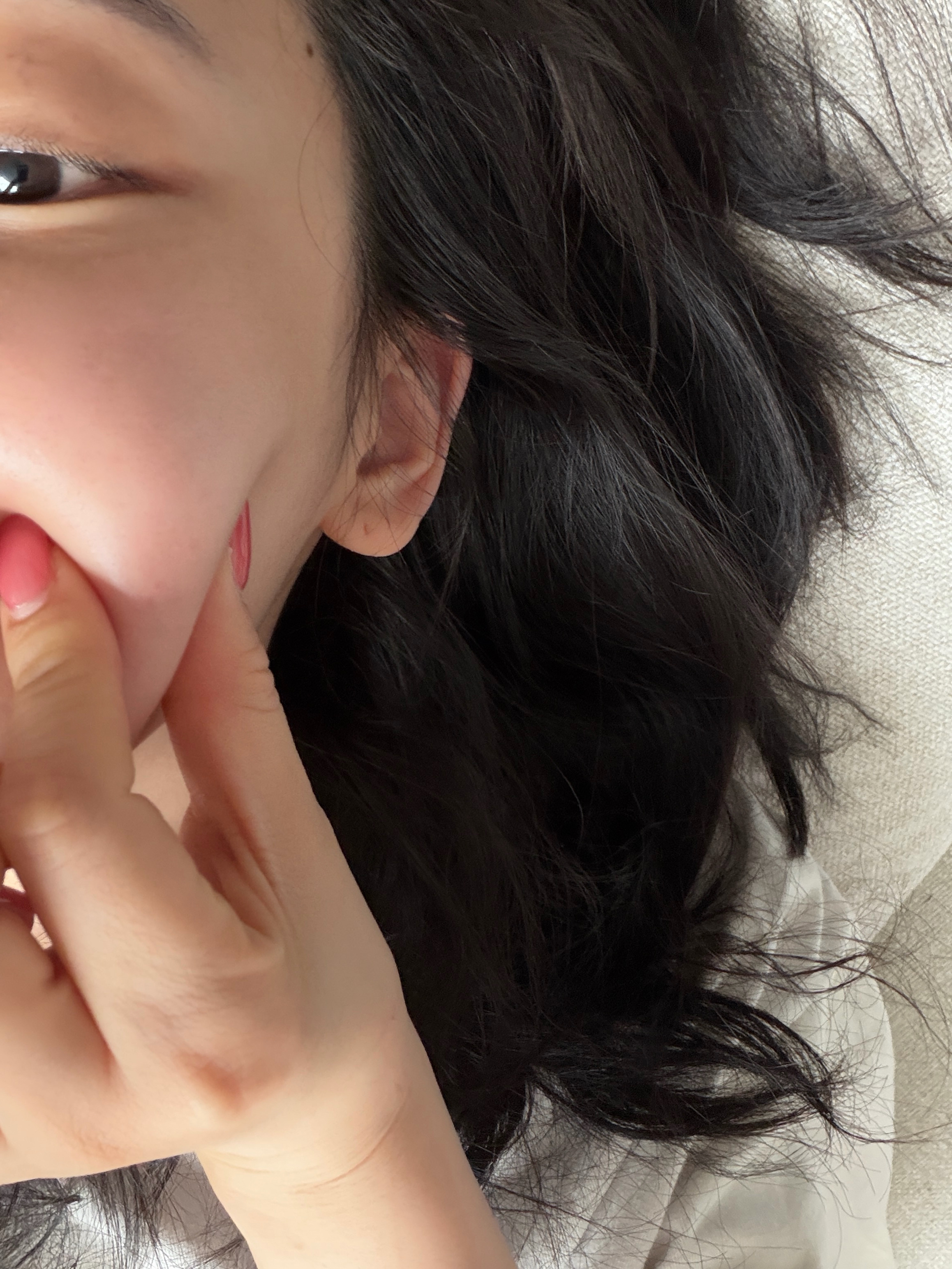 被蚊子迫害的宝宝蛋 