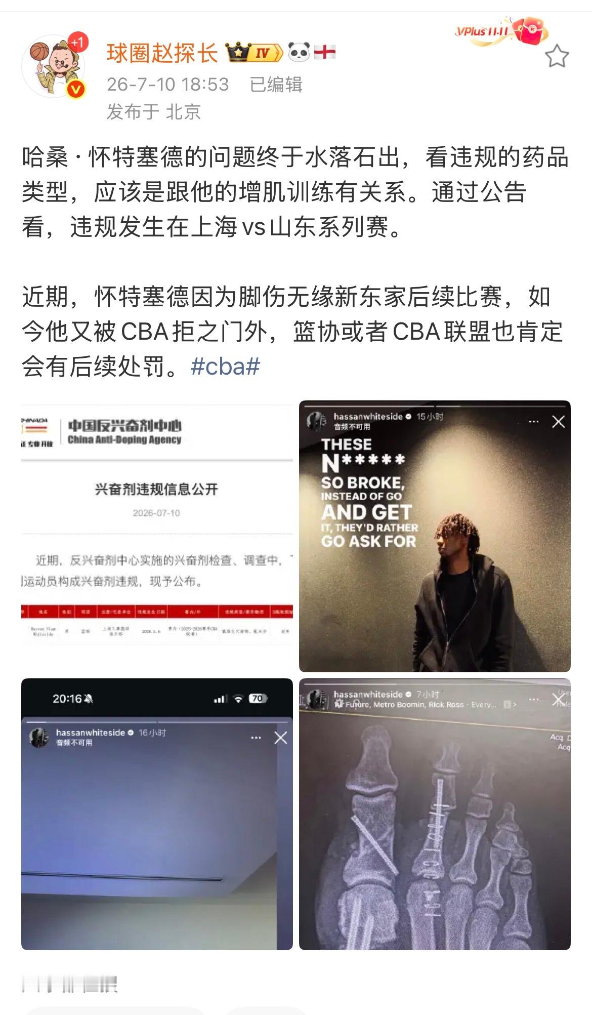 拉伤而已 脚不舒服 增肌而已…有这三连，中国男篮还能好？ 