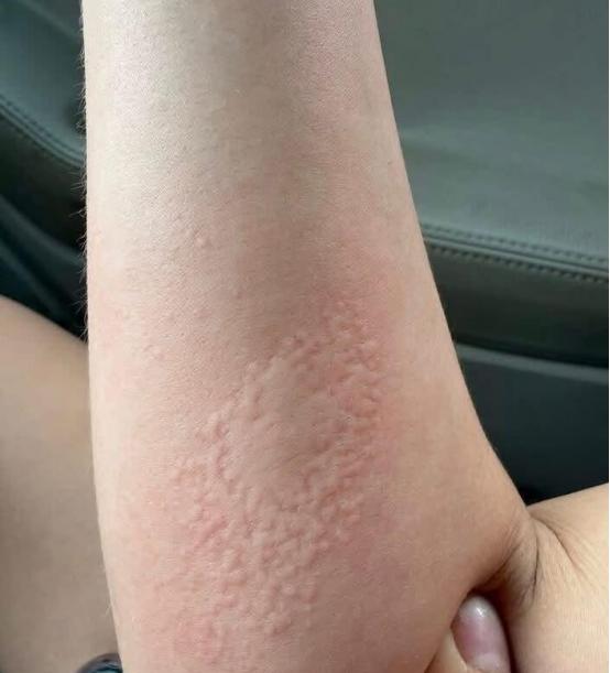 女生在社交软件认识一名外籍男网友，线上聊了没几天就线下约在酒店见面，两人在酒店待