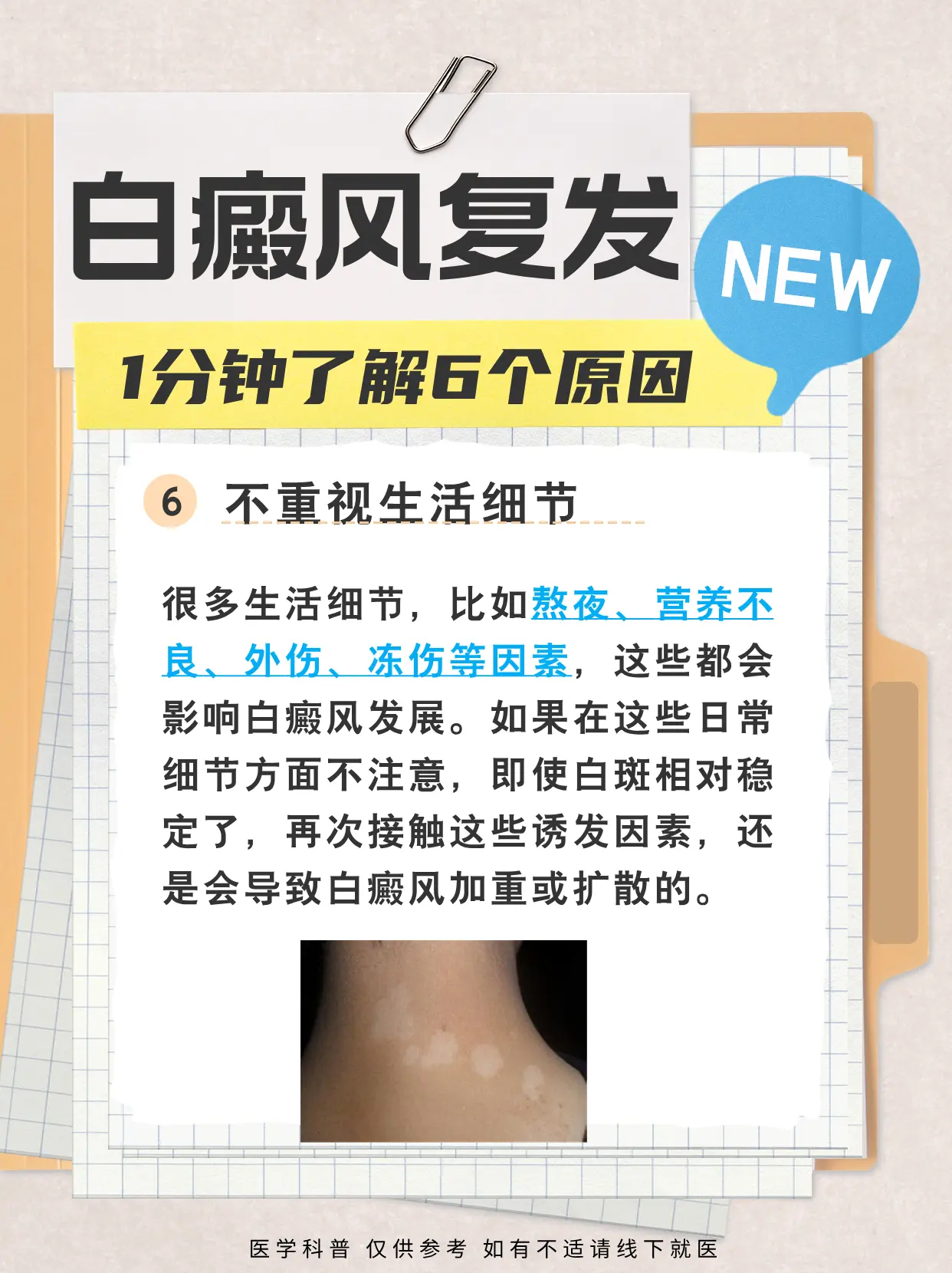 白癜风为什么复发？这些原因要知道