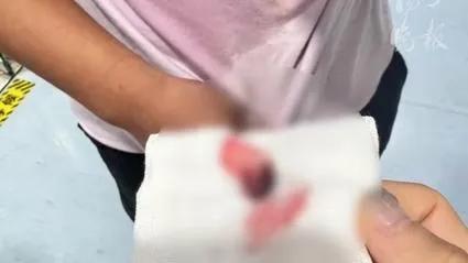 疼痛！疼痛！疼痛！男人和宠物亲吻被咬下半个嘴唇！

不要因为小猫小狗非常聪明而不