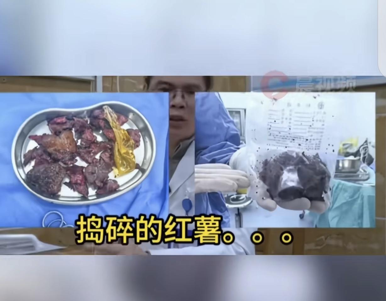 ”太大意！“成都一位61岁的大爷捂着肚子，表情痛苦，说话支支吾吾。在医生耐心询问