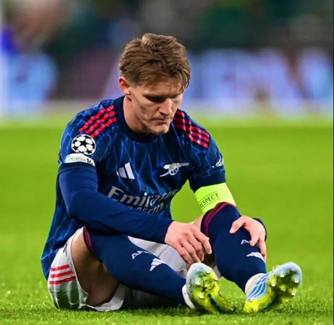 挪威主帅索尔巴肯接受采访时谈到了厄德高的伤势。他表示：“厄德高只是遇到了一点伤势