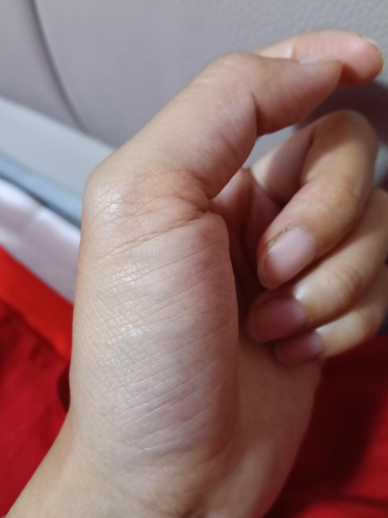 头条有医生吗？可以帮帮我吗？方便问一下大家生孩子是在妇幼保健院还是人民医院生的呀
