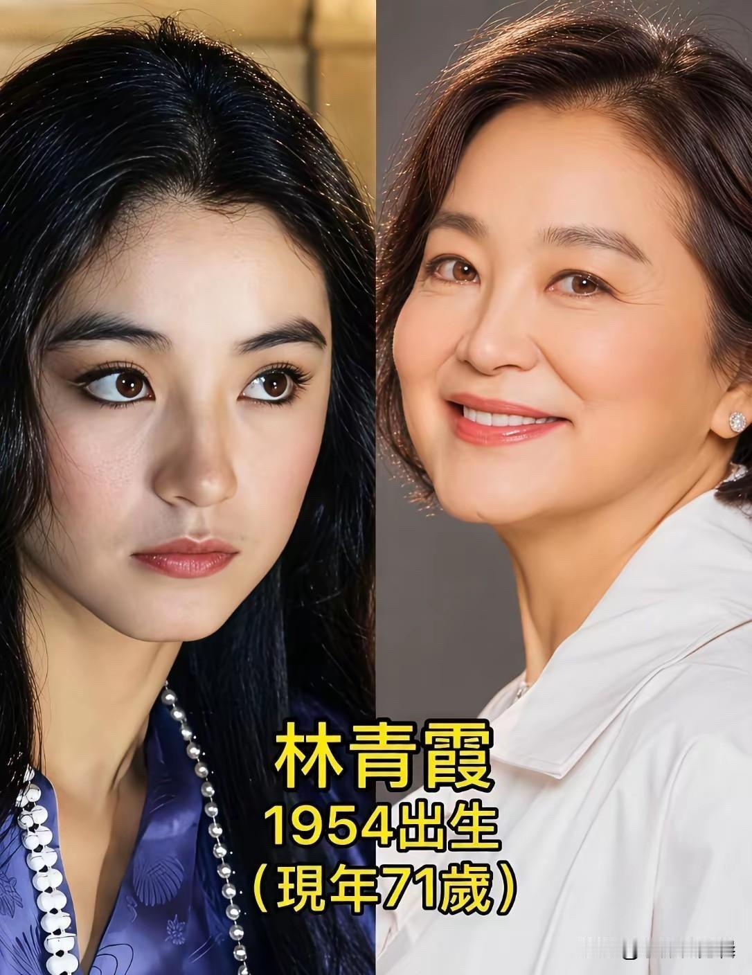 看这几位70岁女星的今昔对比，才发现优雅地老去也是一种本事。

林青霞是很多人心
