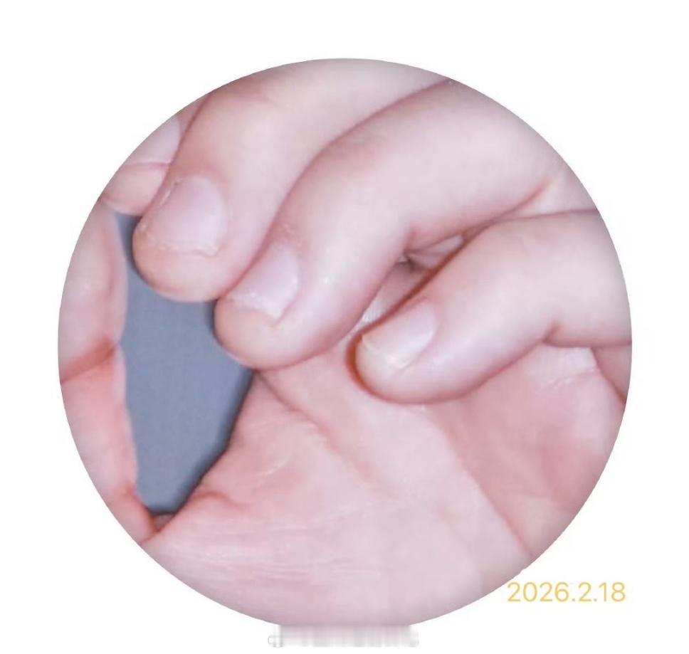 张凌赫是不是也啃指甲啊？我记得朱一龙和丁禹兮也有这个习惯