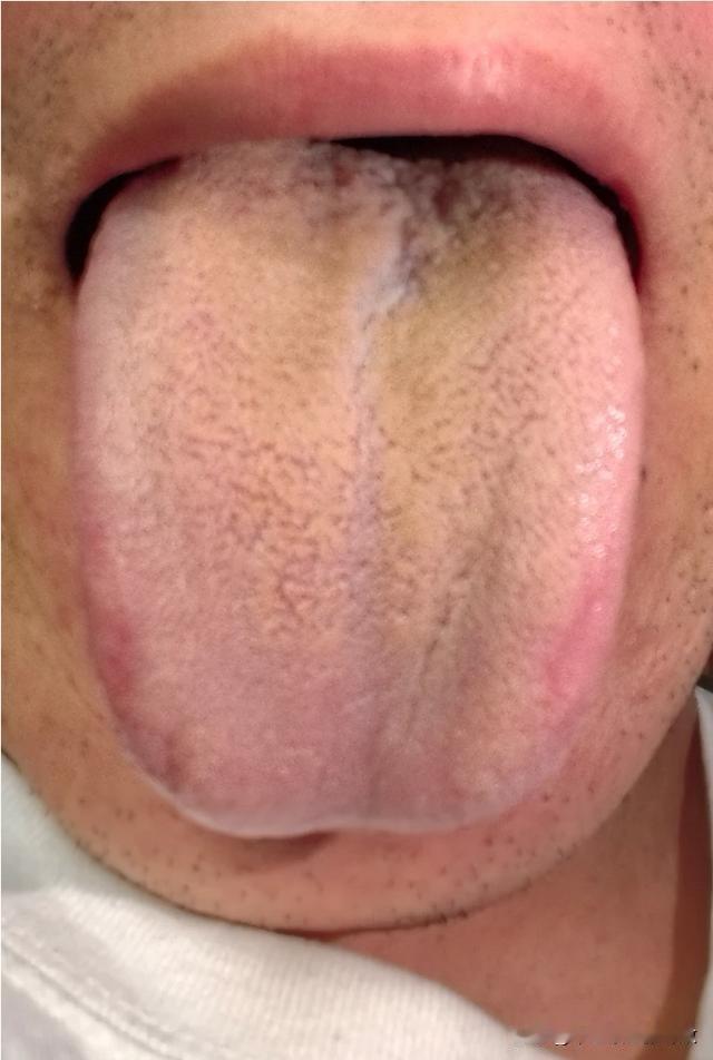 再不节制调理下，别说举起无力，能不能举起还是一回事呢[黑线][黑线]
主诉：小便