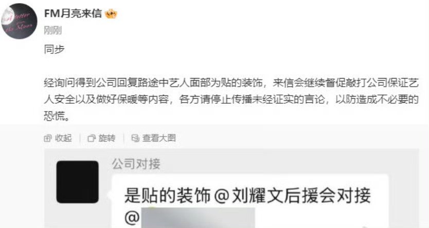 刘耀文脸上是装饰刘耀文的脸没受伤 刘耀文的脸没受伤！ 