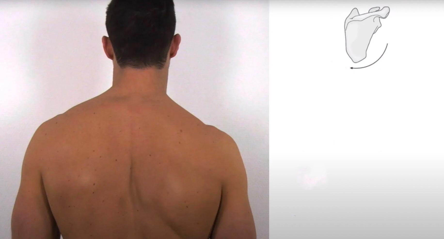 人字肉调整。干货🔥：此类“人字肉”处理原则（局部调整）：根据肌张力平衡理论，处理因肩胛骨下回旋导致的背部斜走向褶皱问题，我们需要放松使肩胛骨下回旋的肌肉，并加强使肩胛骨上回旋的肌肉。
🔥放松策略：针对肩胛提肌、胸小肌和大菱形肌采用适当的放松技巧，如按摩、热疗或指压，以缓解这些肌肉的紧张和挛缩。
🔥加强策略：对于斜方肌上束、斜方肌下束、前锯肌上部、前锯肌下部和小菱形肌，应通过特定的锻炼和伸展练习来加强它们的力量和灵活性，帮助促进肩胛骨的上回旋。
通过平衡这些肌群的力量和灵活性，可以有效地改善背部的褶皱情况，促进更健康、更平衡的体态。