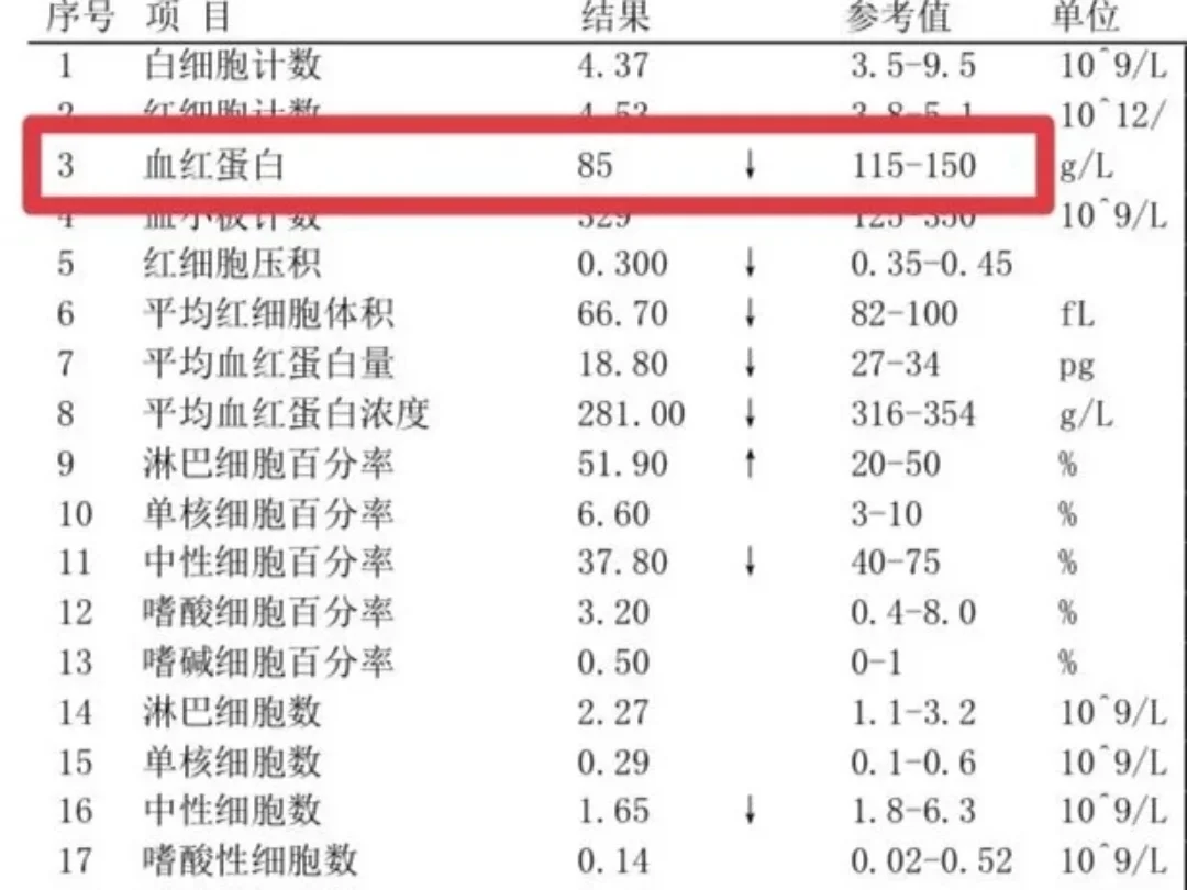 贫血原来可以有这么多症状！!