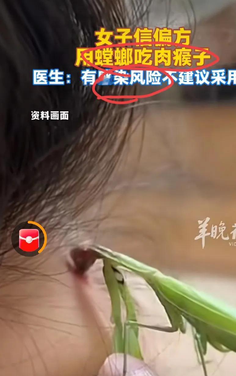 女子用螳螂啃“肉瘊”！偏方治大病？别拿健康赌！
 
山西一女子听信偏方，让螳螂啃