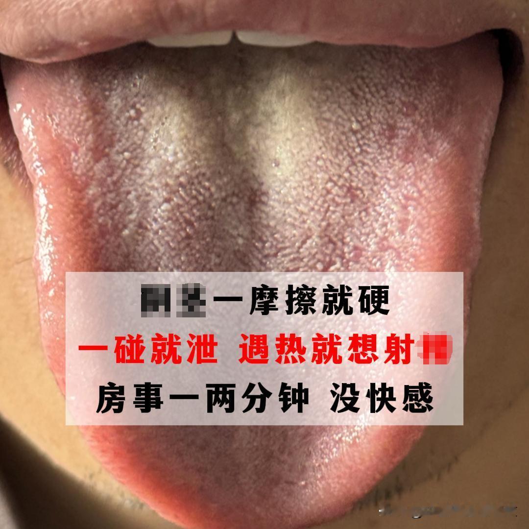 江苏明哥，今年 42 岁，就面临着非常严重的男科障碍[吃瓜群众][吃瓜群众][吃