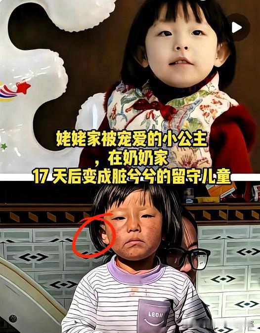 真的看一次心疼一次！
17天的时间，一个眼里有光的小公主，
愣是被磨成了眼神躲闪