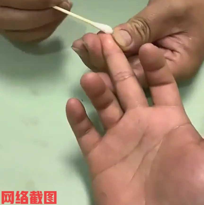 有名女子去医院里采血化验。

本来挺简单的事就几秒的工夫，却被女子怕疼改变了事情