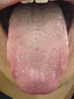 宗筋状态不稳、耐受度差？脾虚肝郁、营卫失和，失眠多梦的中医调治思路





