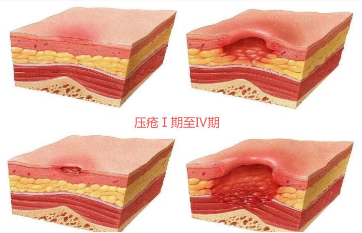 12月24日冬夜寒气袭人，杭州二十一岁的小林像往常一样铺开电热毯想睡个暖和觉。[