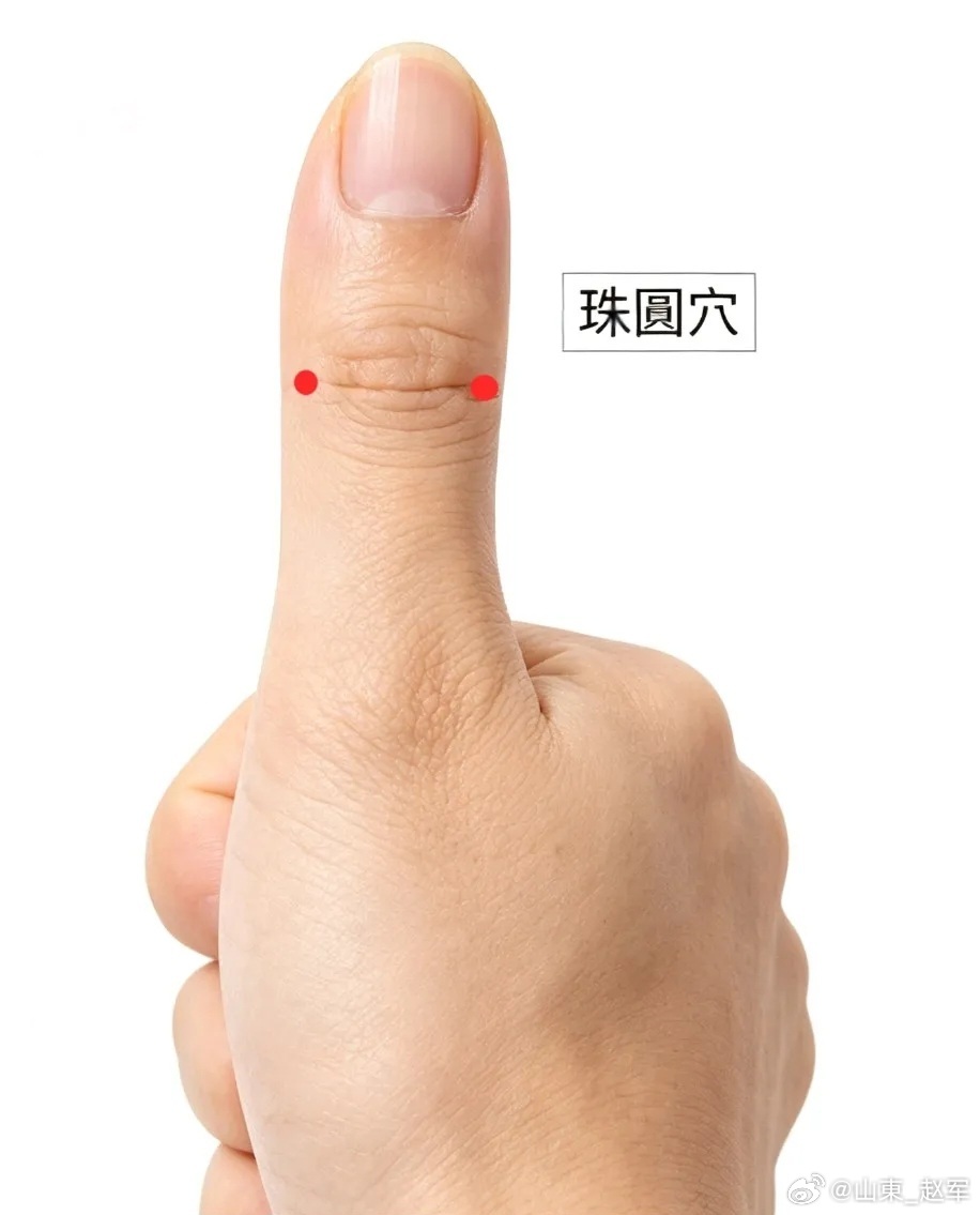 董氏奇穴·珠圆穴完整授课讲义一、穴名释义珠圆，意为“眼珠疾患全包圆”。拇指全息对