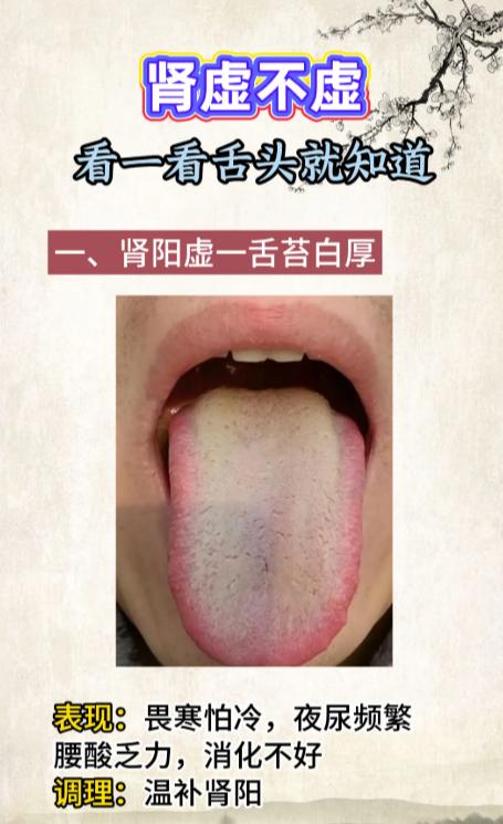 肾气足不足，看舌头就知道！