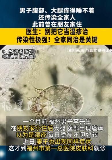 “太可怕了！”7月17日报道，福建，一男子在朋友家小住了几晚，回家后，大腿莫名刺