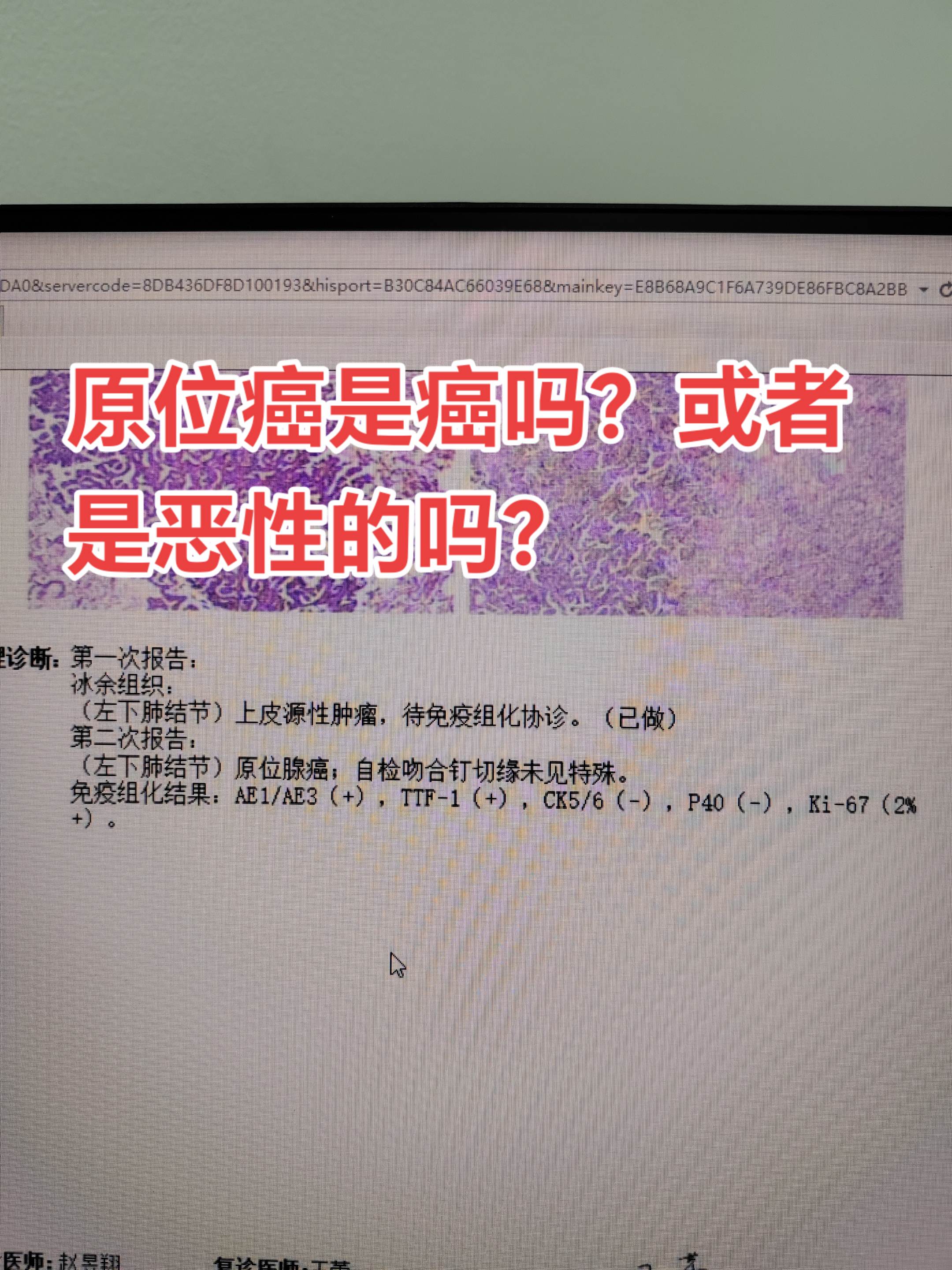 原位癌还是癌吗？真的被 WHO 踢除了？2021版分类在目录编排上进行...