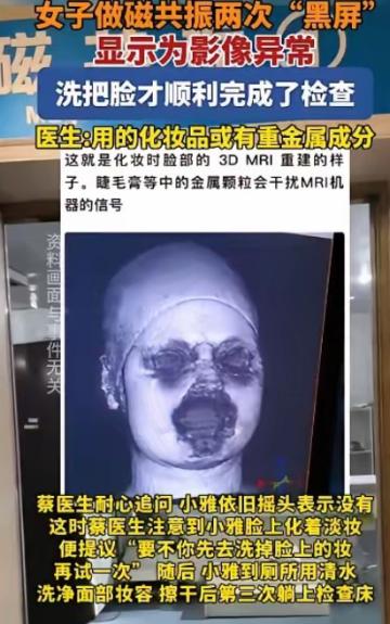 解释不清了！福建一 29 岁女生头晕，去医院做头颅磁共振。不料，连续 2 次扫描