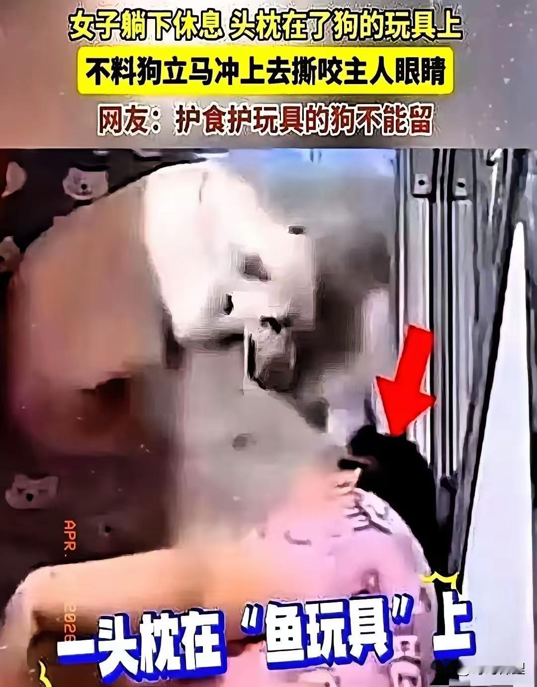 狗东西狗东西！

还迷信狗不咬主人，醒醒吧！

被咬缝了40多针，还要跟狗道歉，