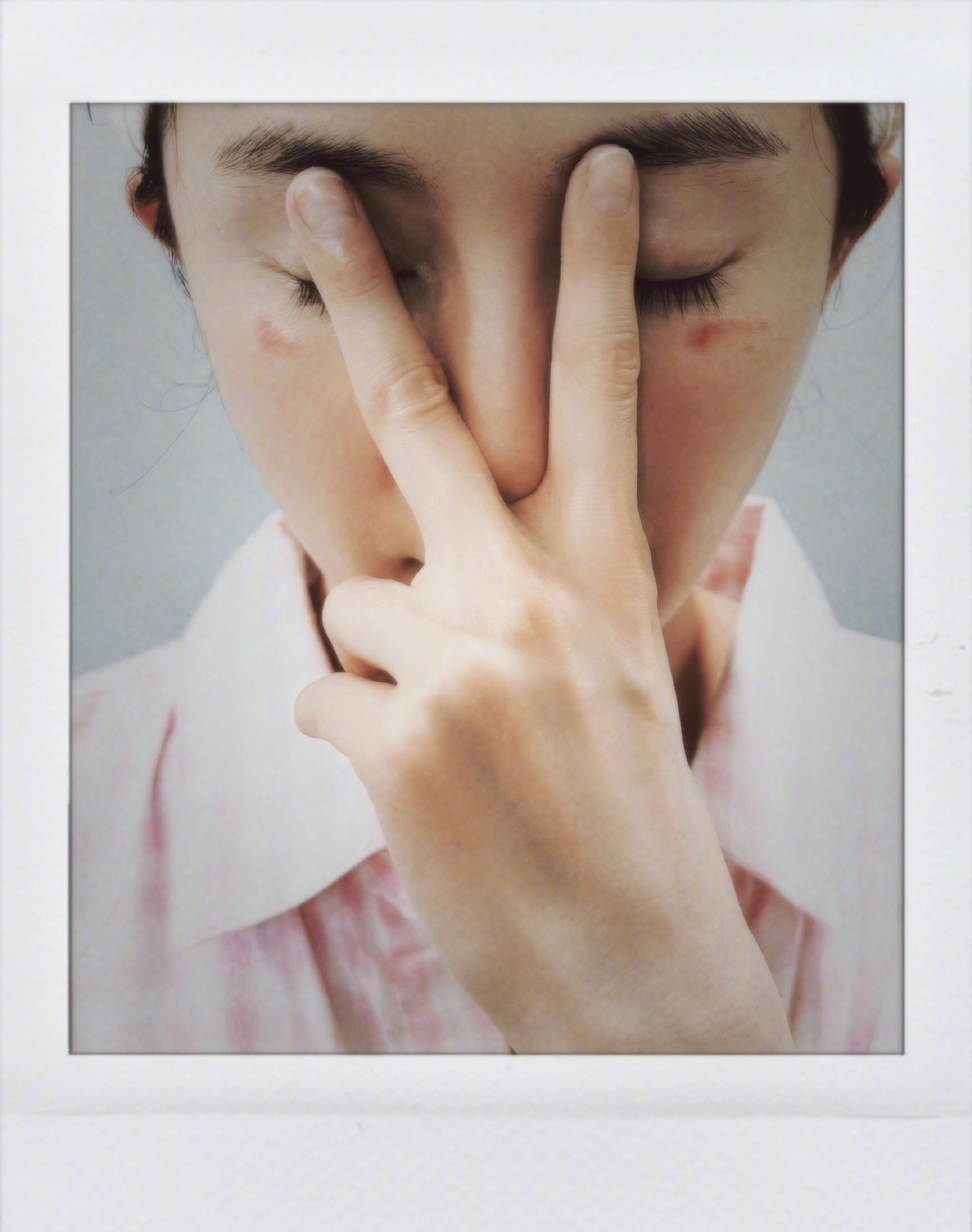 杨幂脸被蒸汽眼罩烫伤了 偶莫偶莫 大家使用蒸汽眼罩要小心啊，幂幂快点好起来 