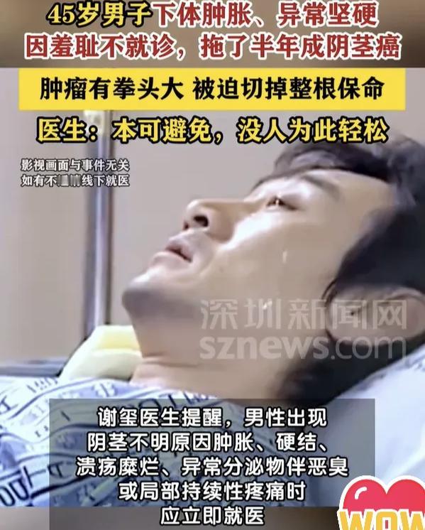 45岁男人隐私出现肿胀 没管，，半年后确诊阴茎癌晚期……
但愿是编出来的故事。