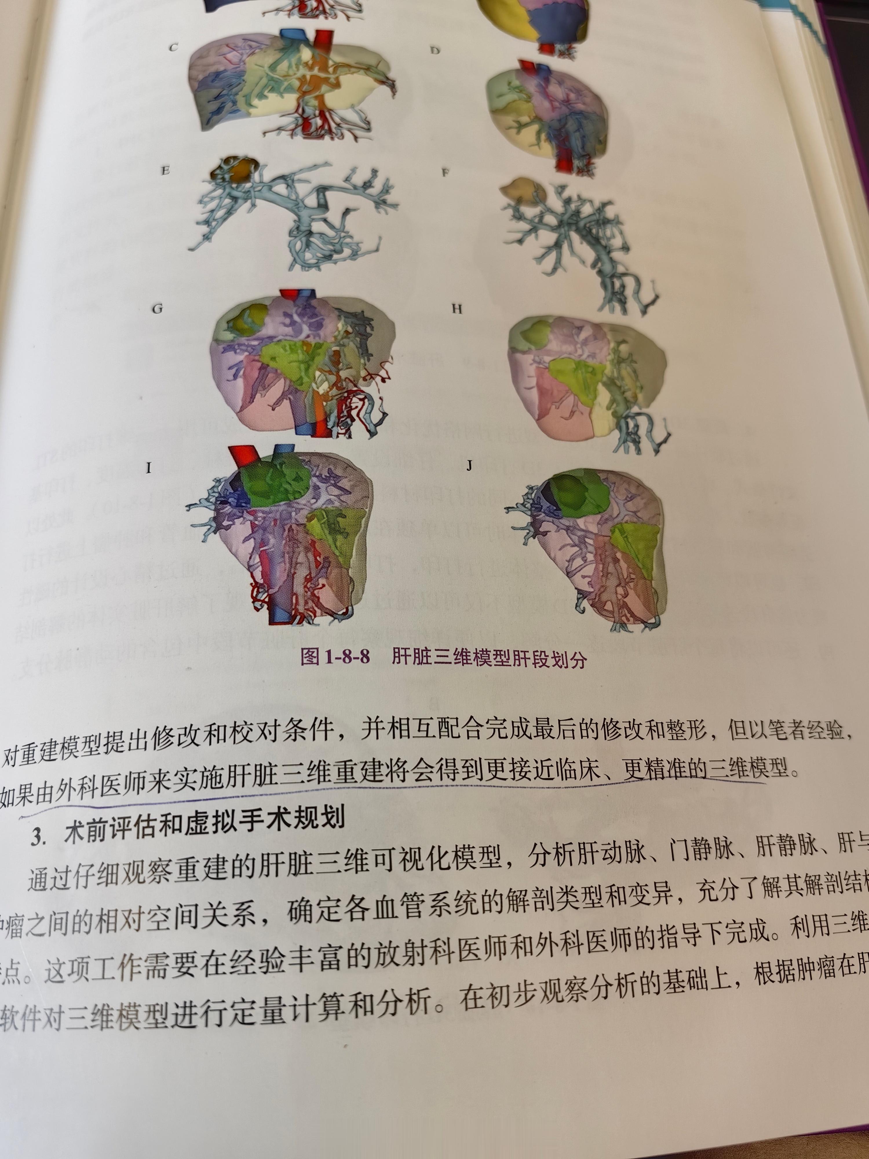 有一个奇葩的外科医生，神经外科的教授，天天开颅的那种。为了让手术做的更好更准，自