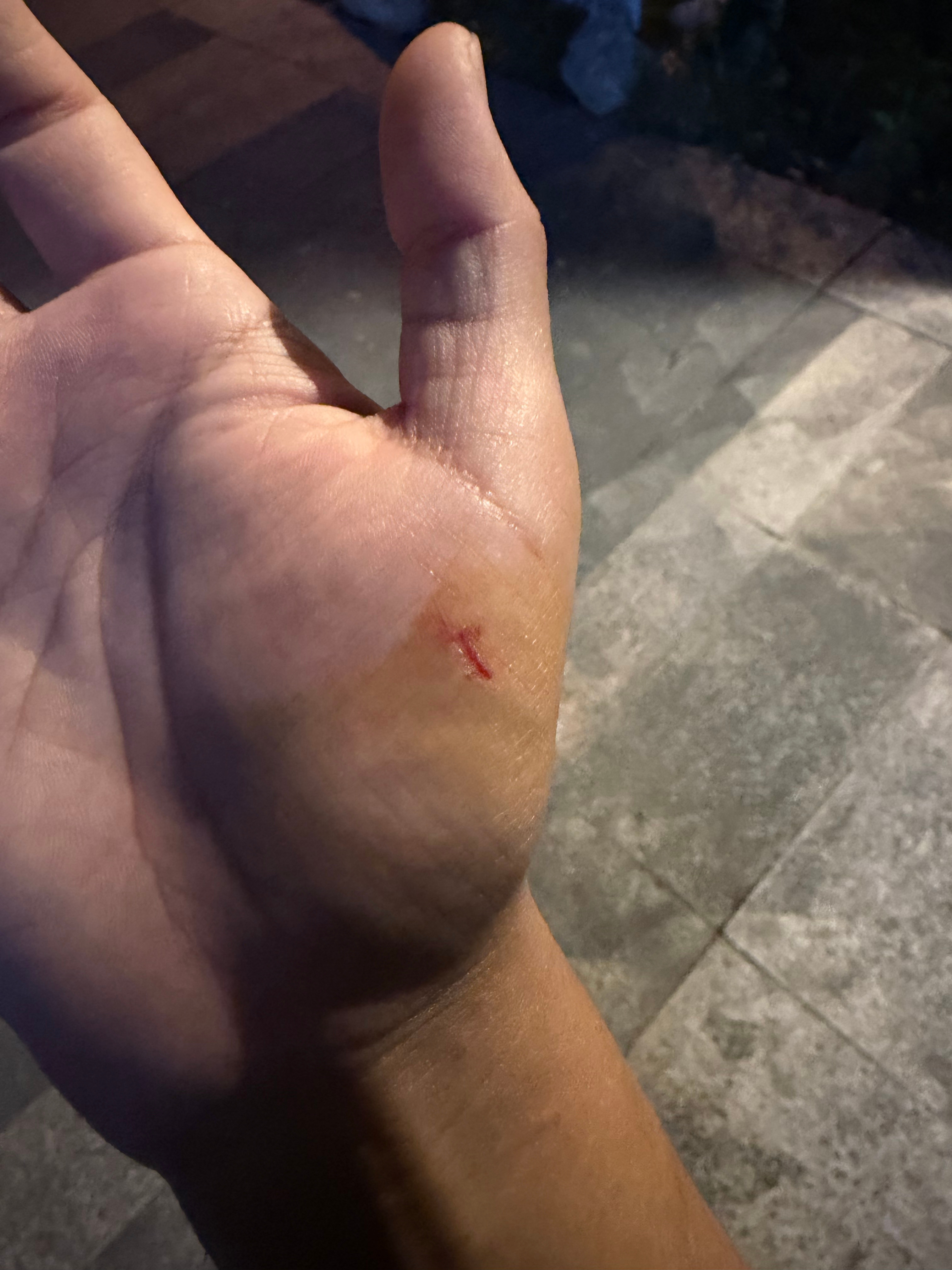 黑猫警长抓的，给我痛死 
