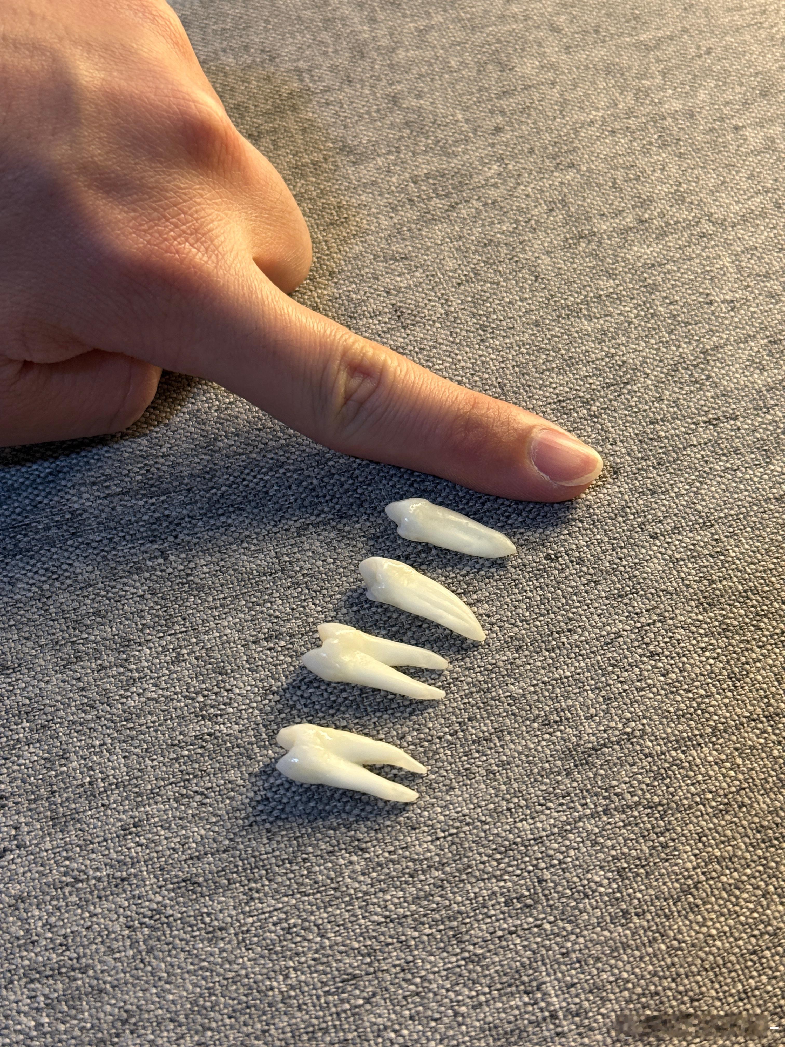 人的牙还是挺长的我带矫正器的时候，需要拔掉四颗健康的牙，现在看到它们，还是很心疼