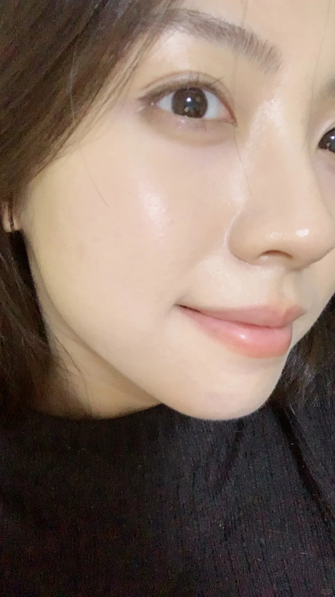 坦白说，我对医美项目越来越谨慎了，效果和自然度必须兼得。惟她天使真的让我安心，用