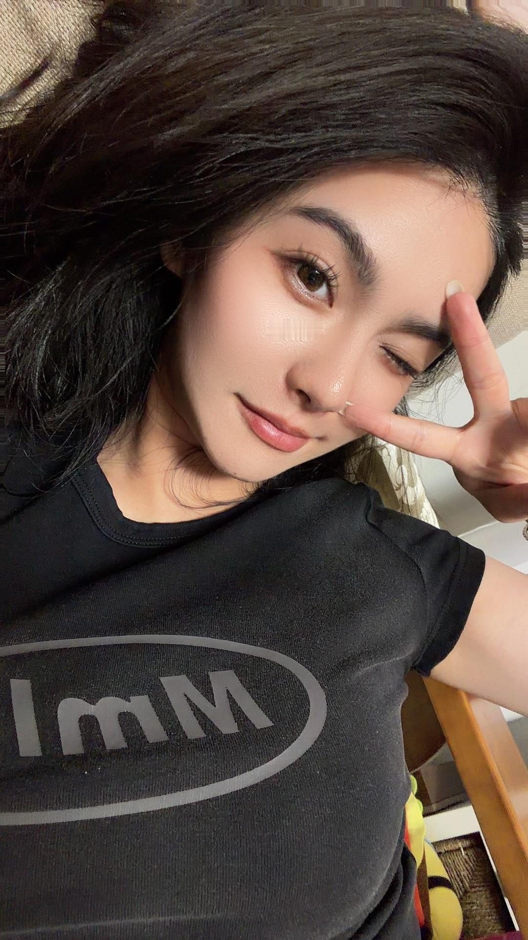 胳膊上长了小湿疹，我回家我妈妈第一眼就看到了～突然觉得妈妈对她崽的爱就是：什么细