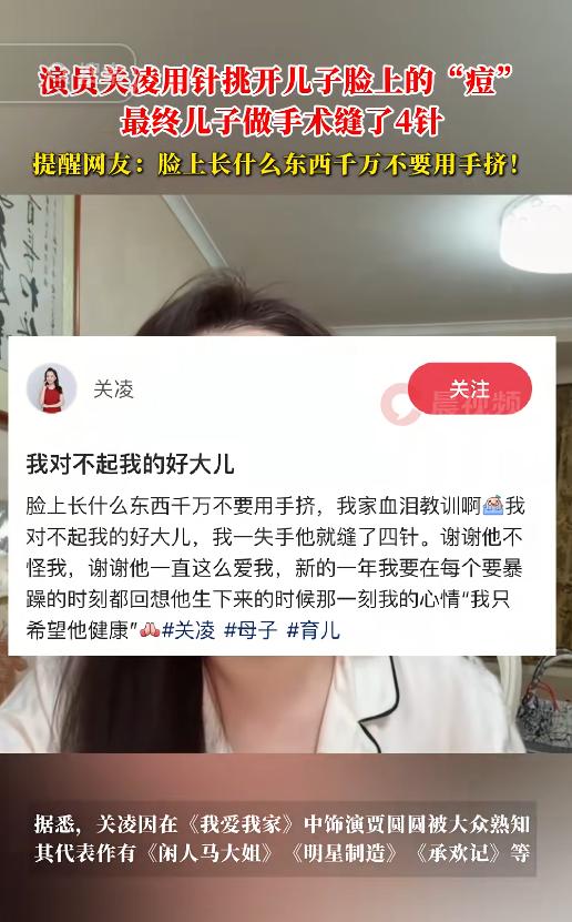 脸上的“痘”不要乱挤，演员关凌儿子乱挤缝了4针

1月5日，演员关凌在社媒发了一