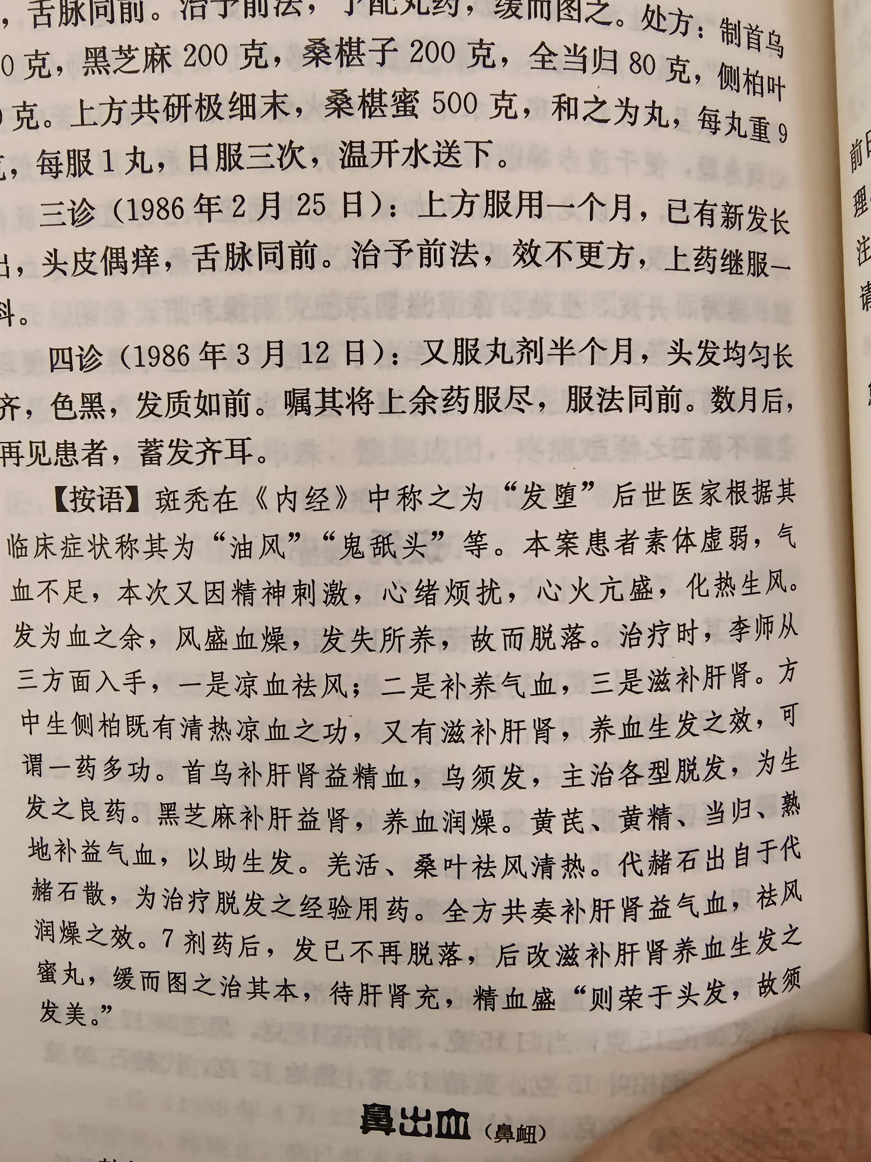 代赭石散脱发经验用药#中医# ​​​