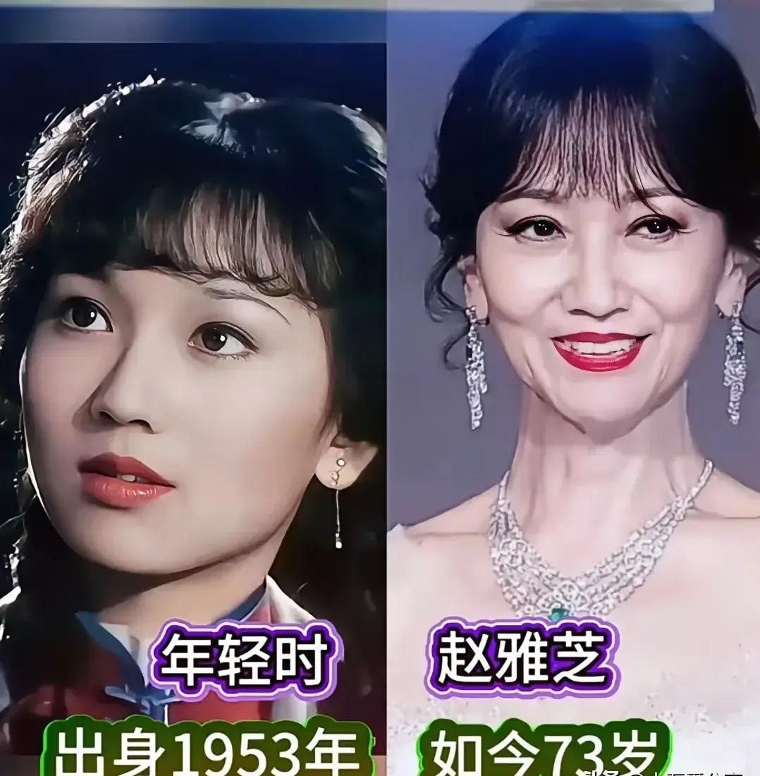 娱乐圈长青树，不老女神，赵雅芝，王丽云，王馥荔。她们的肌肤通透紧致，五官端正，气