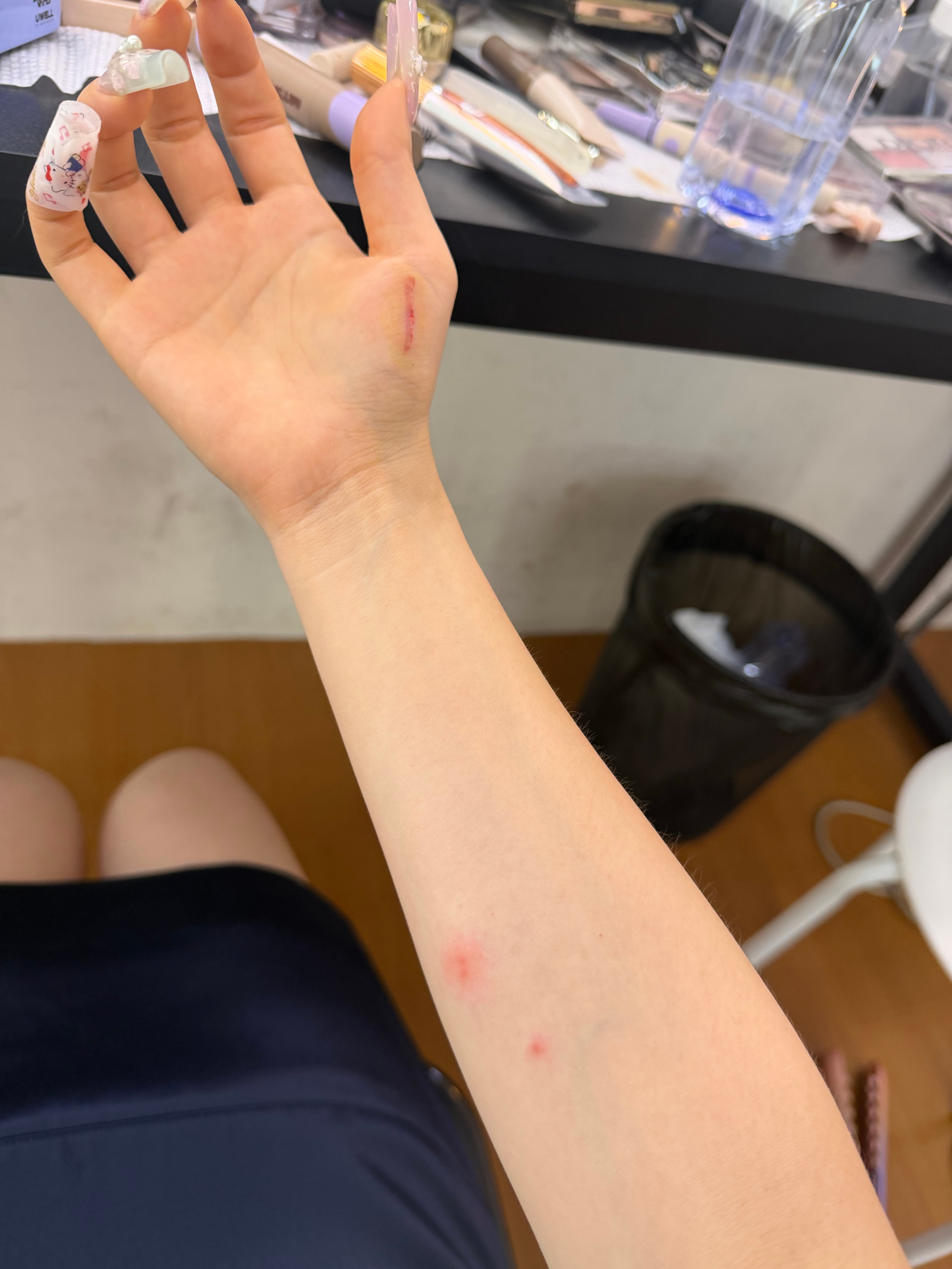 右手伤口+1始作俑者： 