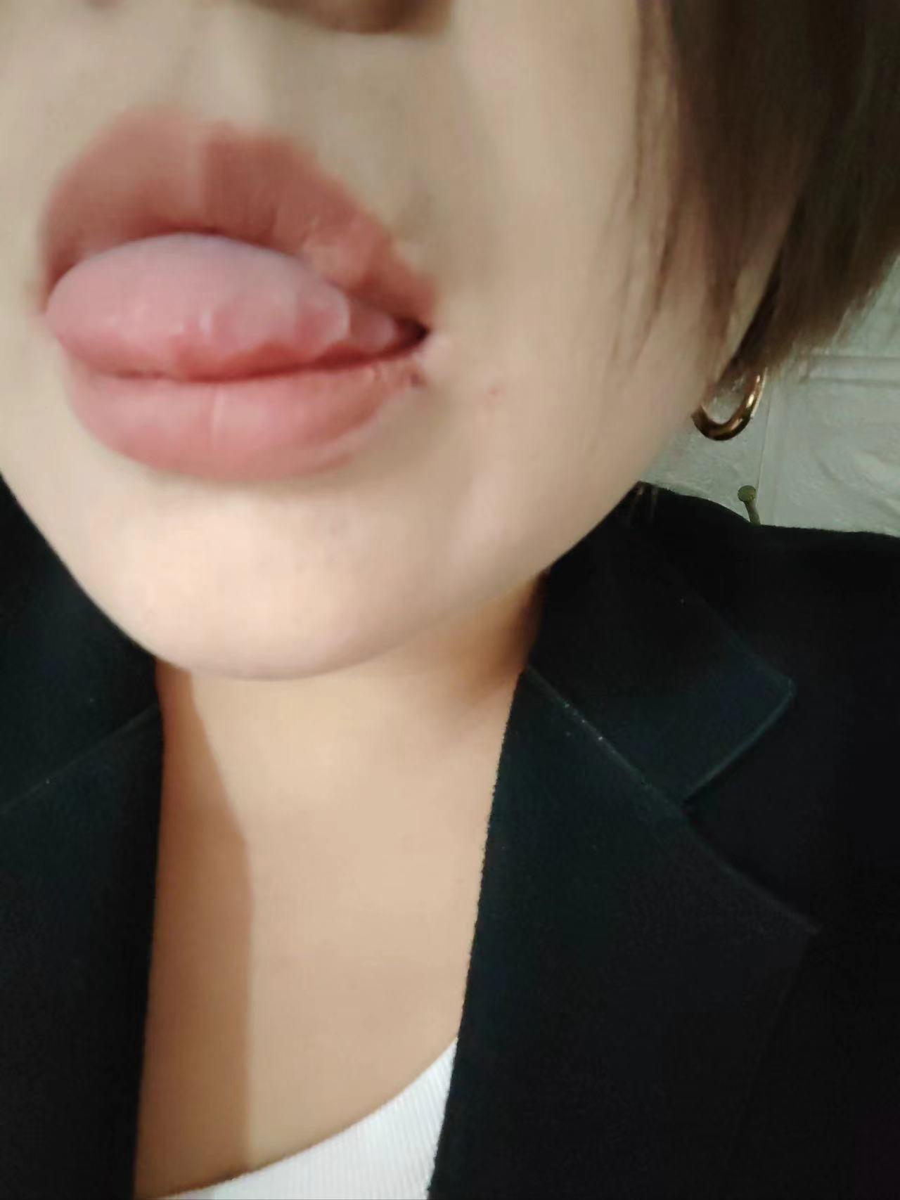 病友上来第一句，我舌头太吓人了，这代表什么？[what][what][what]