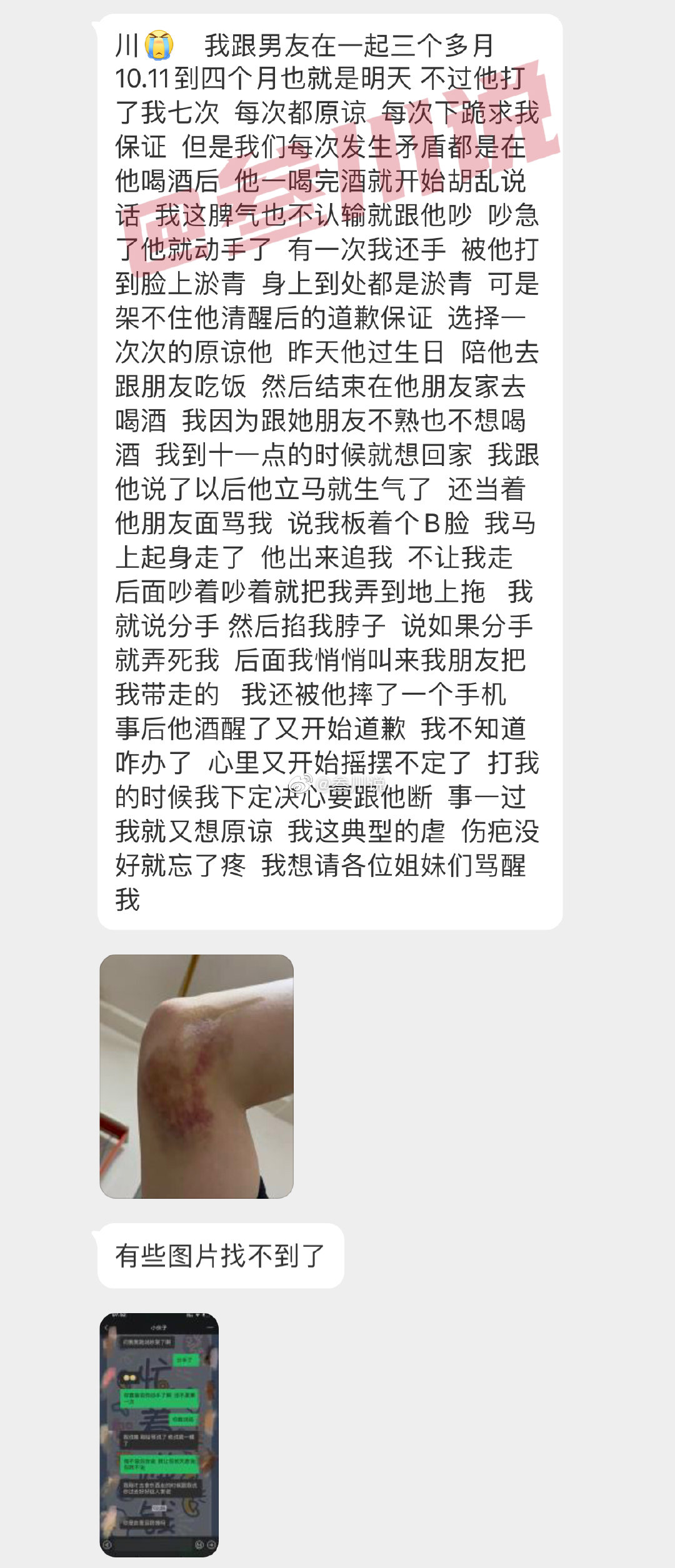 男朋友爱我的方式有点特别，动不动就喜欢揍我一顿！ ​​​