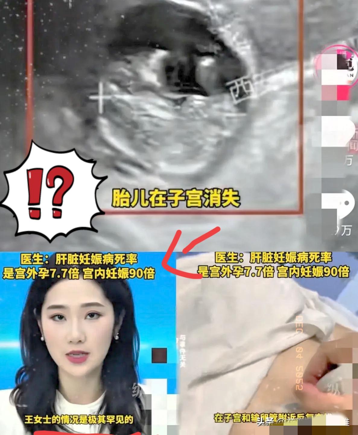 惊掉我下巴了！这事儿光是听着都后背发凉，生孩子真的是在闯生死关！
 
西安40岁